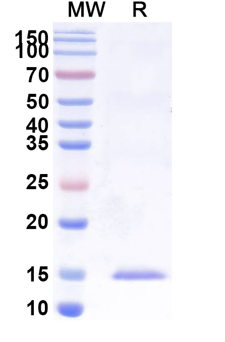 SDS-PAGE for Anti-Castor bean Ricin VHH (SAA0988)