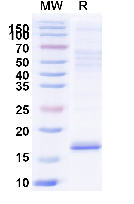 SDS-PAGE for Anti-Castor bean Ricin VHH (SAA0991)