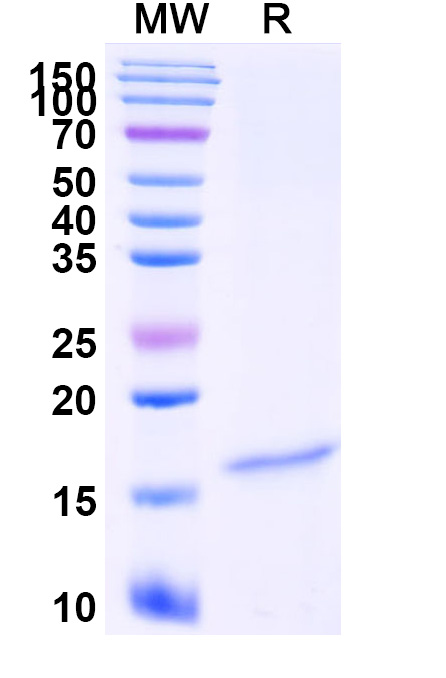 SDS-PAGE for Anti-Castor bean Ricin VHH (SAA0998)