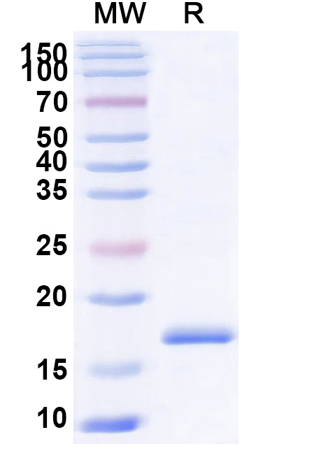 SDS-PAGE for Anti-Castor bean Ricin VHH (SAA1000)