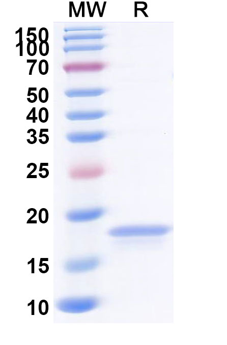 SDS-PAGE for Anti-Castor bean Ricin VHH (SAA1002)