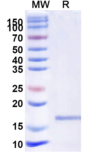 SDS-PAGE for Anti-Castor bean Ricin VHH (SAA1088)
