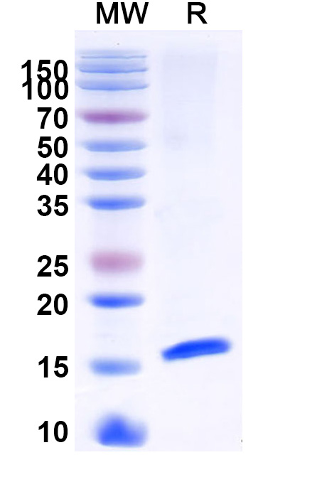 SDS-PAGE for Anti-Castor bean Ricin VHH (SAA1119)