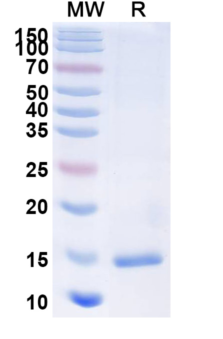 SDS-PAGE for Anti-Castor bean Ricin VHH (SAA1138)