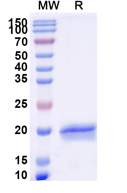 SDS-PAGE for Anti-Castor bean Ricin VHH (SAA1143)