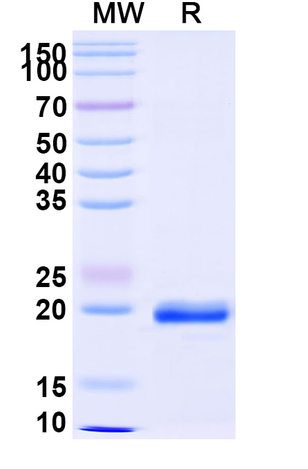 SDS-PAGE for Anti-Castor bean Ricin VHH (SAA1148)