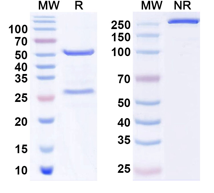 SDS-PAGE for Anti-Cav1.2/1.3 Ca2+ channel Antibody (L57/23)