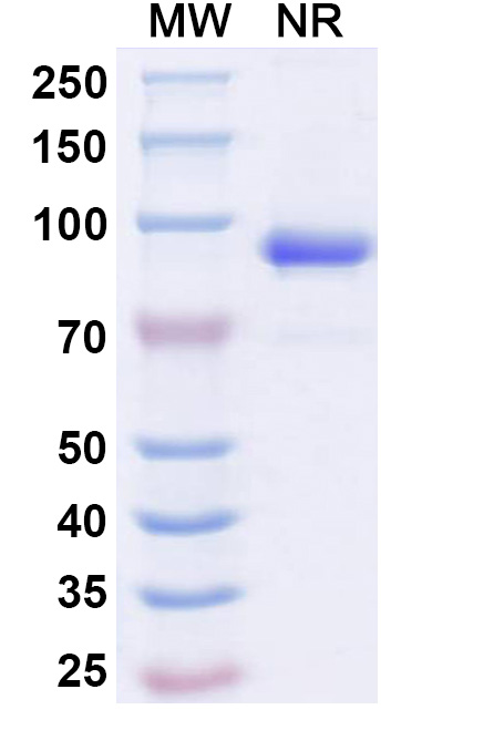 SDS-PAGE for Anti-CHIKV NSP2 Antibody (Nb-A9)
