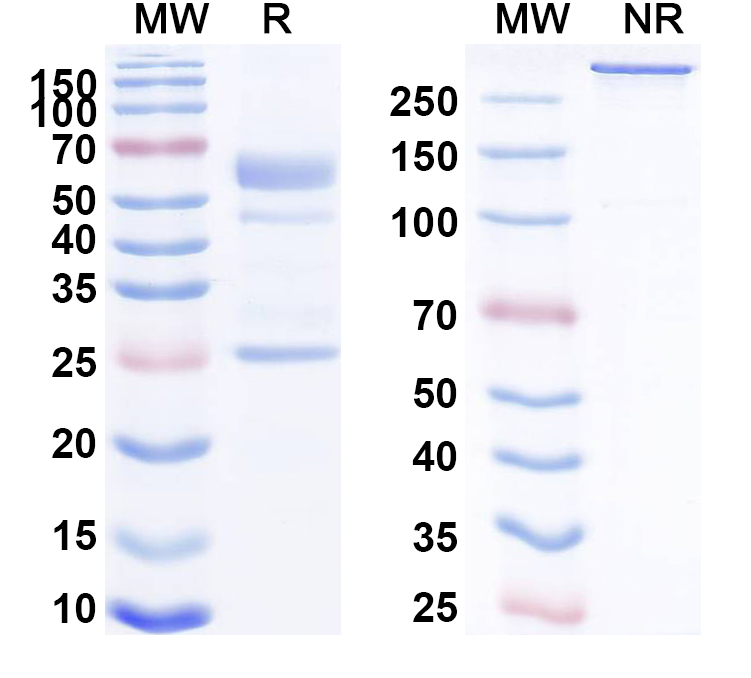 SDS-PAGE for Anti-CHIKV Spike glycoprotein E2 Antibody (5F10)