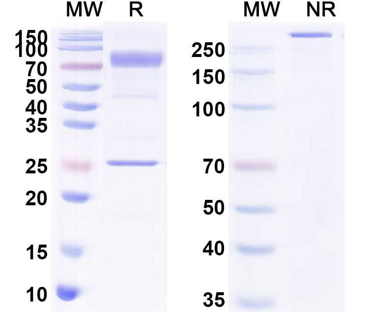SDS-PAGE for Anti-CHIKV Spike glycoprotein E2 Antibody (5F10)