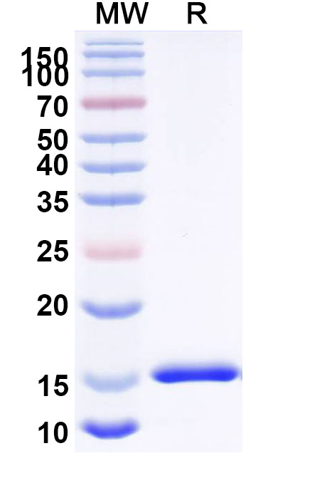 SDS-PAGE for Anti-Clostridioides difficile Toxin A/tcdA VHH (SAA0992)