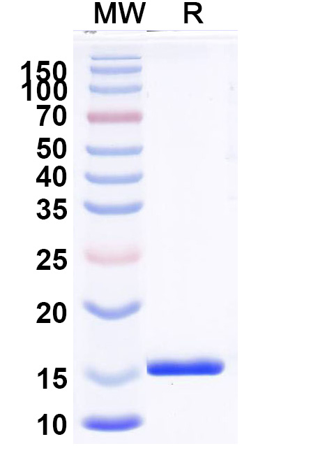 SDS-PAGE for Anti-Clostridioides difficile Toxin B/tcdB VHH (SAA1083)