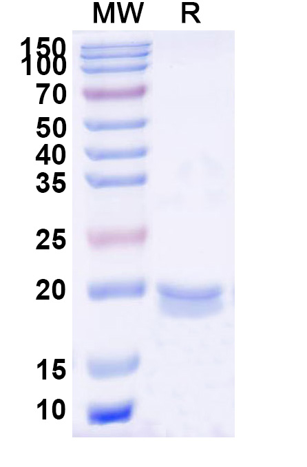 SDS-PAGE for Anti-Clostridium botulinum BoNT/B VHH (SAA0938)