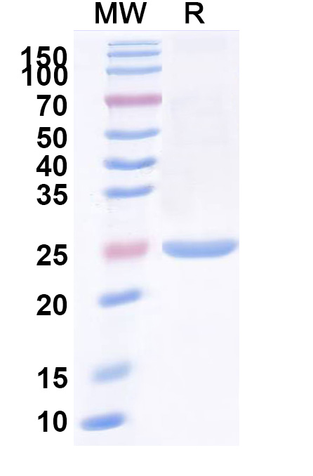SDS-PAGE for Anti-Clostridium botulinum BoNT/B VHH (SAA0939)