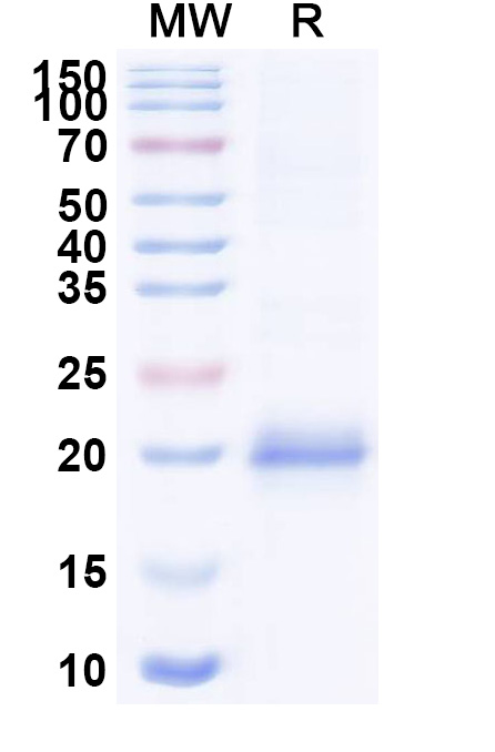 SDS-PAGE for Anti-Clostridium botulinum BoNT/B VHH (SAA0940)