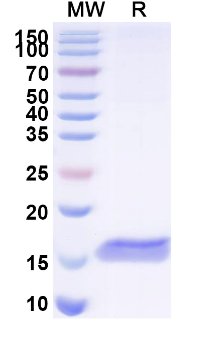 SDS-PAGE for Anti-Clostridium botulinum BoNT/B VHH (SAA0977)