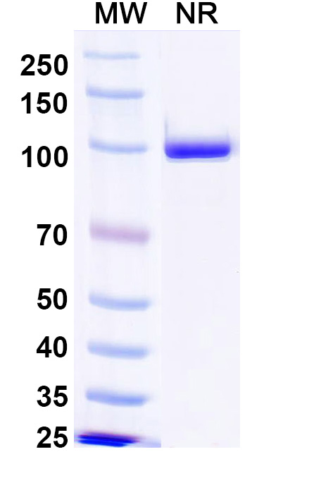SDS-PAGE for Anti-Clostridium botulinum botA/BoNT Antibody (F12)
