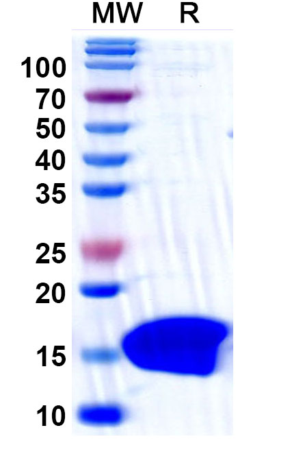 SDS-PAGE for Anti-Clostridium botulinum botA/BOTOX Antibody (SAA1450)
