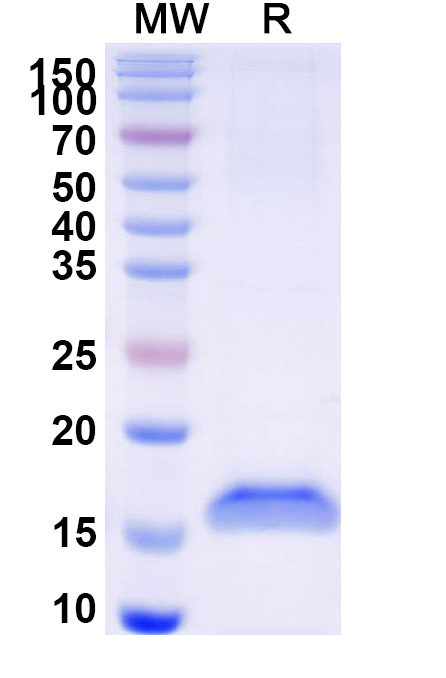 SDS-PAGE for Anti-Clostridium botulinum botA/BOTOX VHH (SAA0925)
