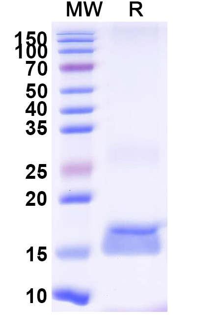 SDS-PAGE for Anti-Clostridium botulinum botA/BOTOX VHH (SAA0930)