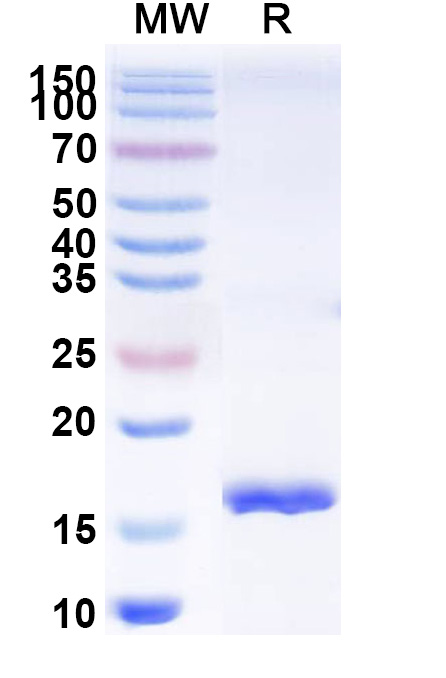 SDS-PAGE for Anti-Clostridium botulinum botA/BOTOX VHH (SAA0932)