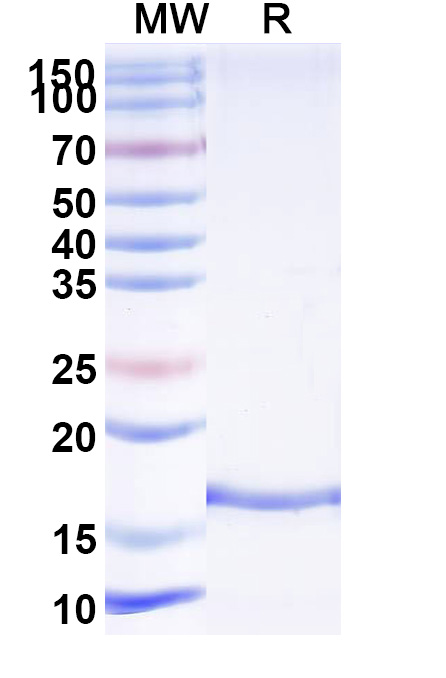 SDS-PAGE for Anti-Clostridium botulinum botA/BOTOX VHH (SAA0933)