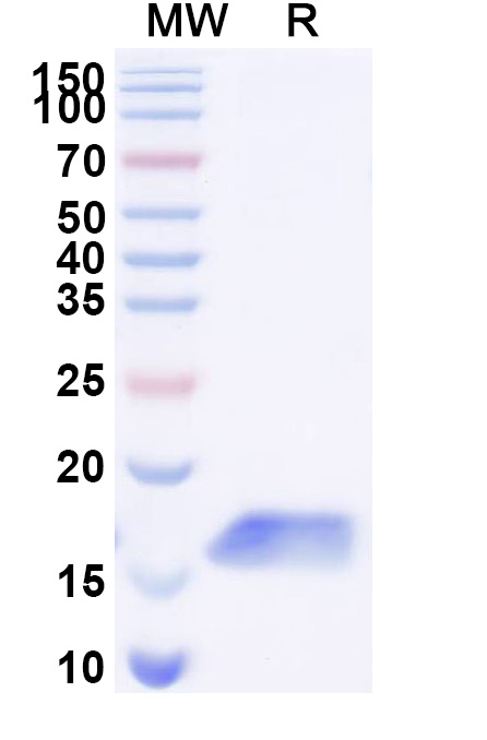 SDS-PAGE for Anti-Clostridium botulinum botA/BOTOX VHH (SAA0936)