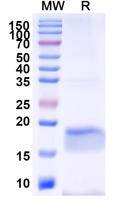 SDS-PAGE for Anti-Clostridium botulinum botA/BOTOX VHH (SAA1350)