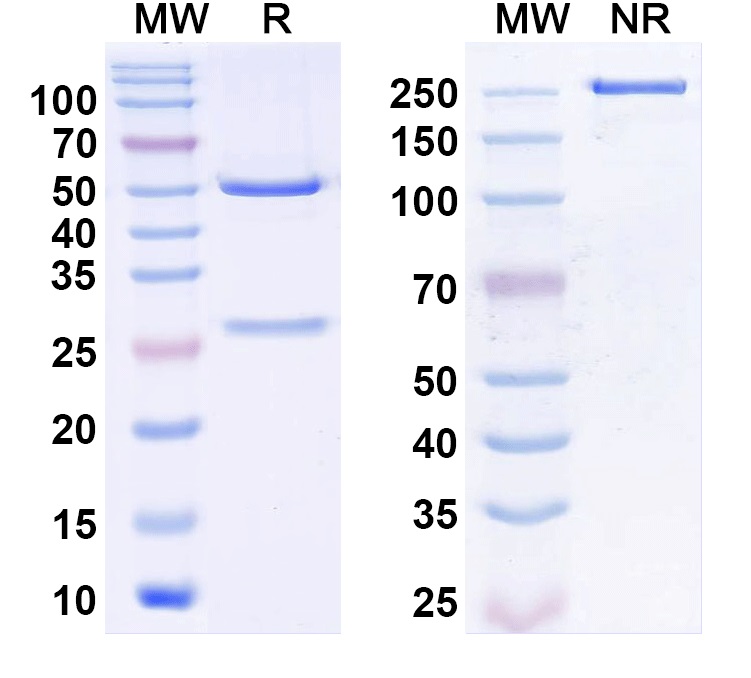 SDS-PAGE for Anti-Clostridium tetani tetX/Tetanus toxin Antibody (SAA2390)