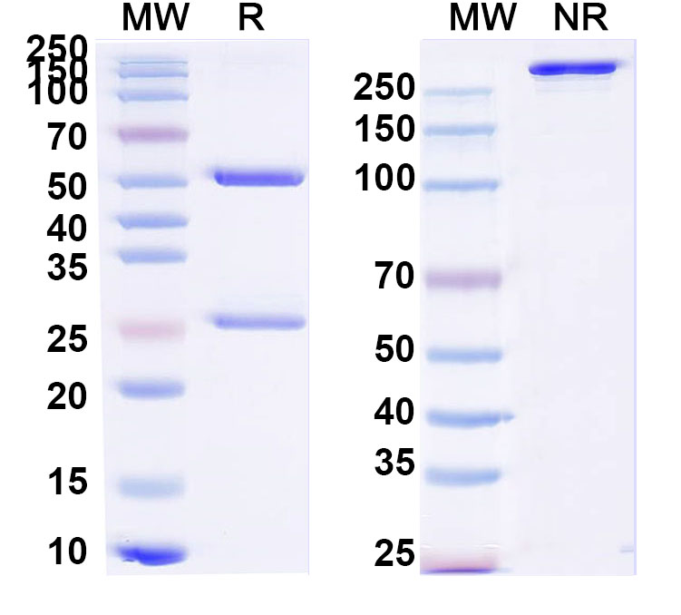 SDS-PAGE for Anti-Clostridium tetani tetX/Tetanus toxin Monoclonal Antibody, SAA0801