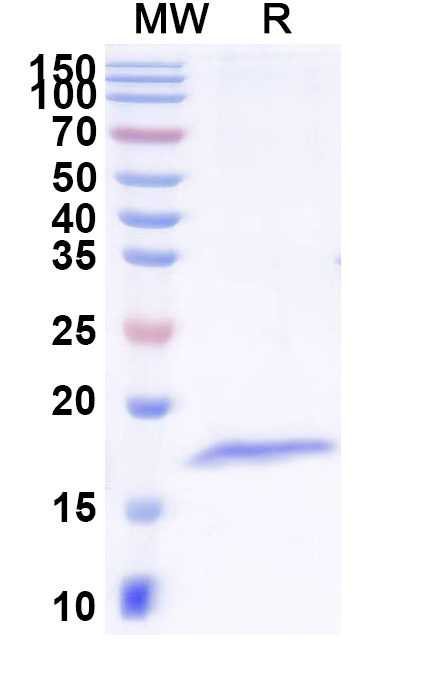 SDS-PAGE for Anti-Clostridium tetani tetX/Tetanus toxin VHH (SAA1236)