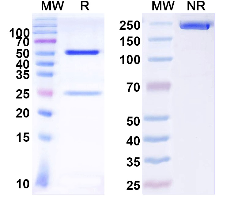 SDS-PAGE for Anti-Coxsackievirus A16/CVA16 Capsid protein/Genome polyprotein Antibody (SAA0355)