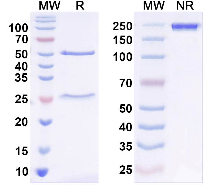 SDS-PAGE for Anti-Coxsackievirus A6/CVA6 VP1/Capsid protein VP1 Monoclonal Antibody, SAA0354