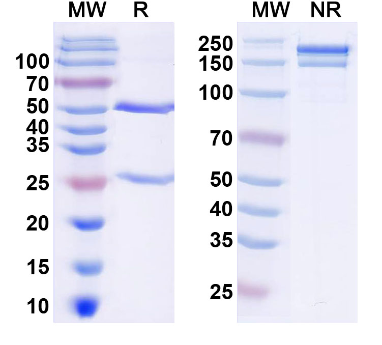 SDS-PAGE for Anti-Cryptosporidium parvum CPS-500 antigen Antibody  (SAA2329)