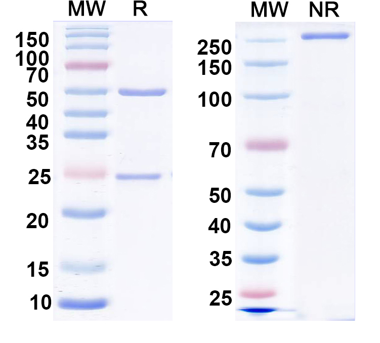 SDS-PAGE for Anti-DEPDC5 Antibody (N463/45)