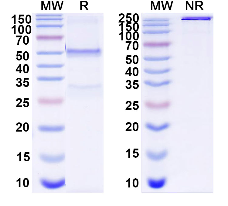 SDS-PAGE for Anti-DNA Antibody (111.68)