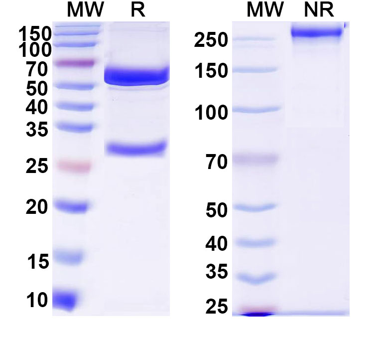 SDS-PAGE for Anti-DNA Antibody (17p.73)