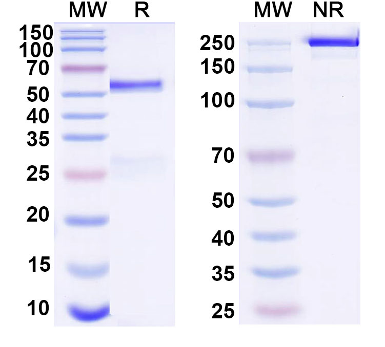 SDS-PAGE for Anti-DNA Antibody (17p.80)