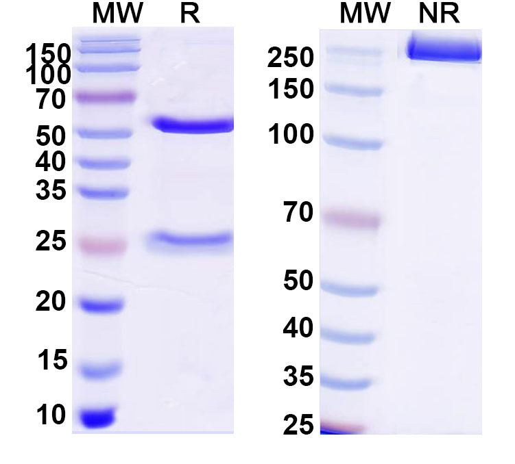 SDS-PAGE for Anti-DNA Antibody (202.105)
