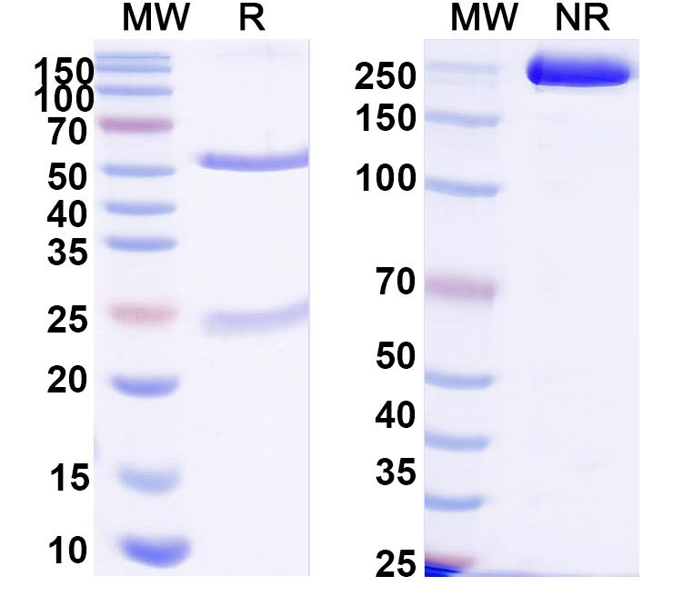 SDS-PAGE for Anti-DNA Antibody (202.61)