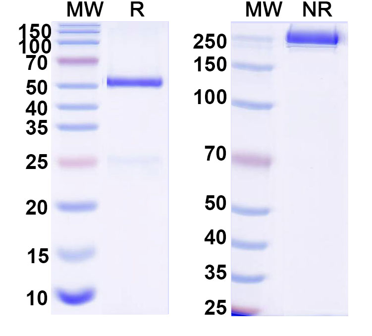 SDS-PAGE for Anti-DNA Antibody (202.9)