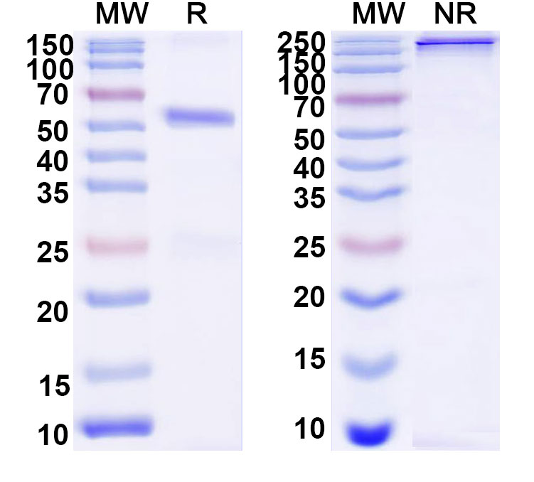 SDS-PAGE for Anti-DNA Antibody (DP1)