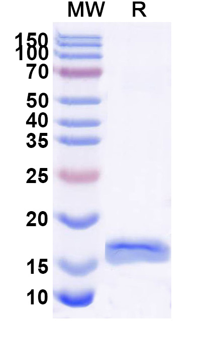 SDS-PAGE for Anti-DNA G-quadruplex Structures VHH&reg; (SG4)