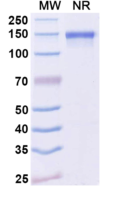 SDS-PAGE for Anti-Dupilumab Neutralizing Antibody (ABS1096)