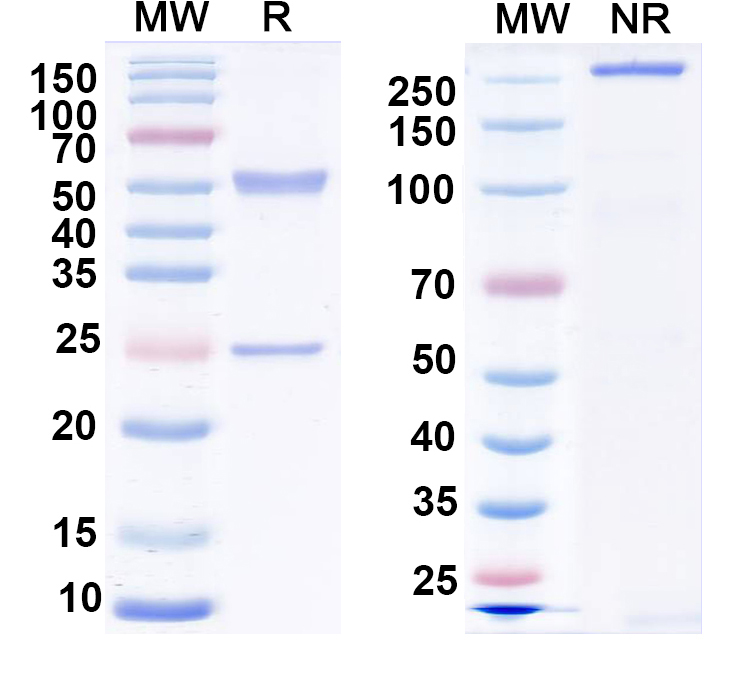 SDS-PAGE for Anti-EAAC1 Antibody (N420/24)