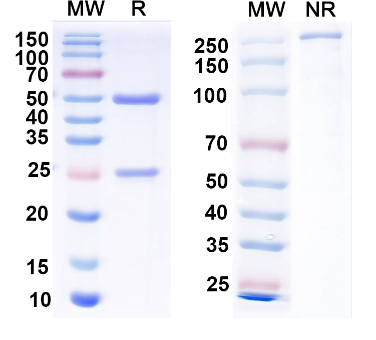 SDS-PAGE for Anti-EBV/HHV-4 gL/BKRF2 Antibody (E1D1)