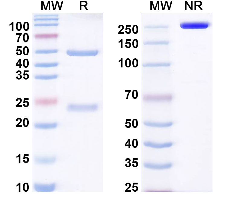SDS-PAGE for Anti-EBV/HHV-4 LMP1/BNLF1 Antibody (E2)