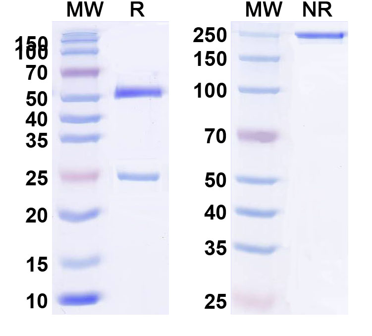 SDS-PAGE for Anti-Eimeria tenella Membrane-associated calcum-binding protein Monoclonal Antibody (1A148)