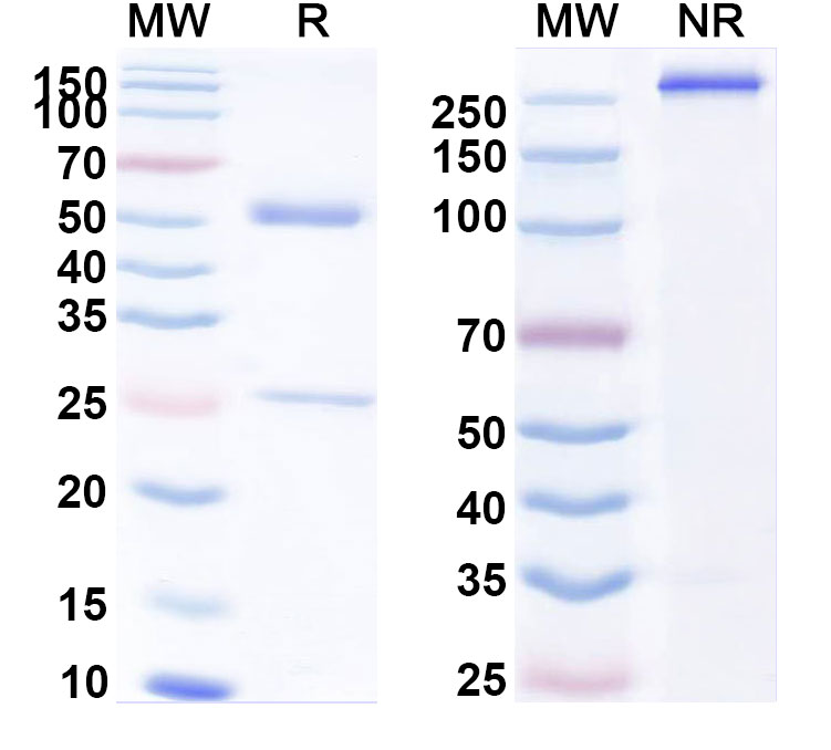 SDS-PAGE for Anti-Eimeria tenella Microneme protein Monoclonal Antibody (1A149)