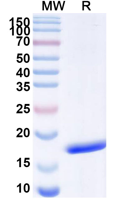 SDS-PAGE for Anti-European white birch Bet v 1/Allergen Bet v I-A VHH (SAA1357)